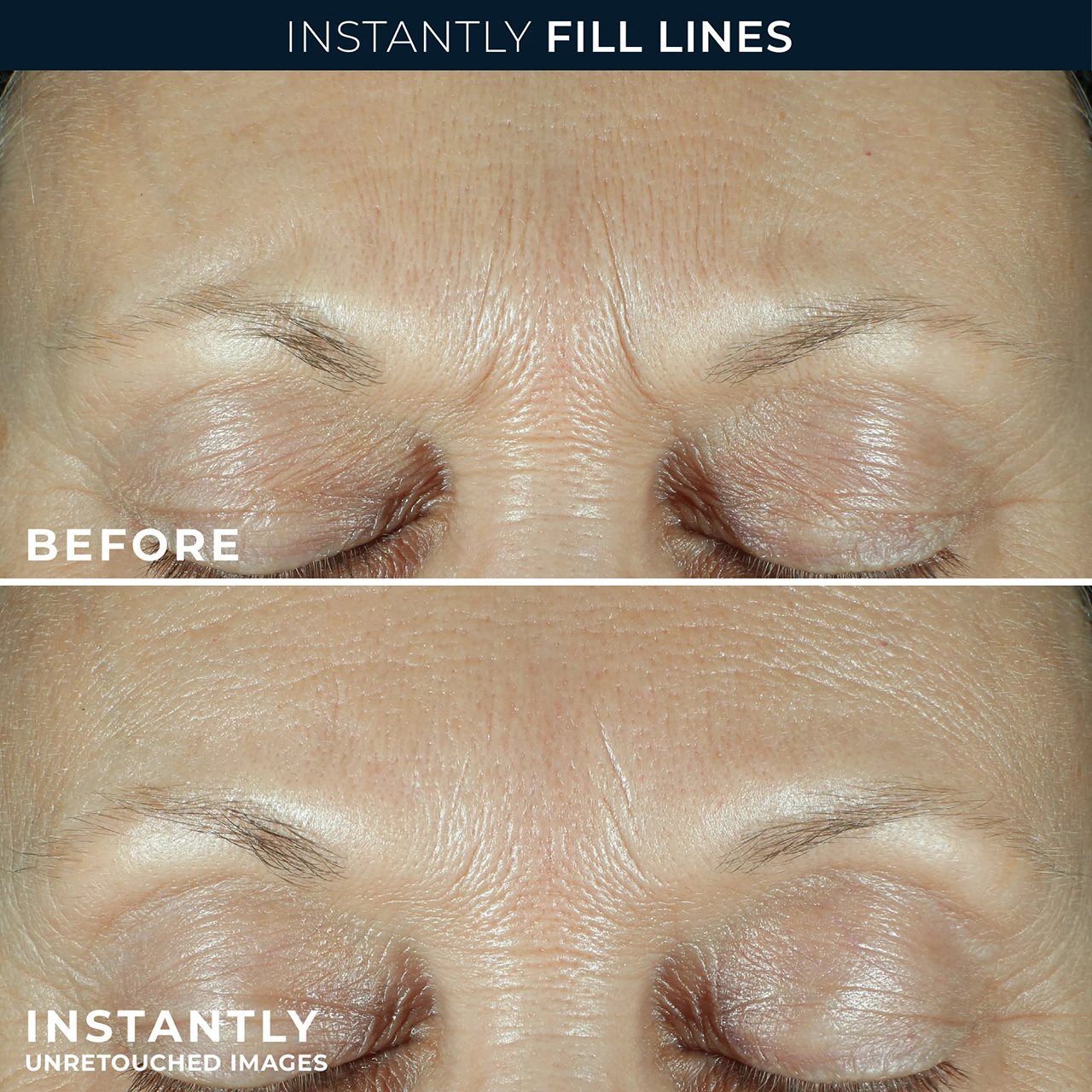 Woman's facial feature before and after Roc